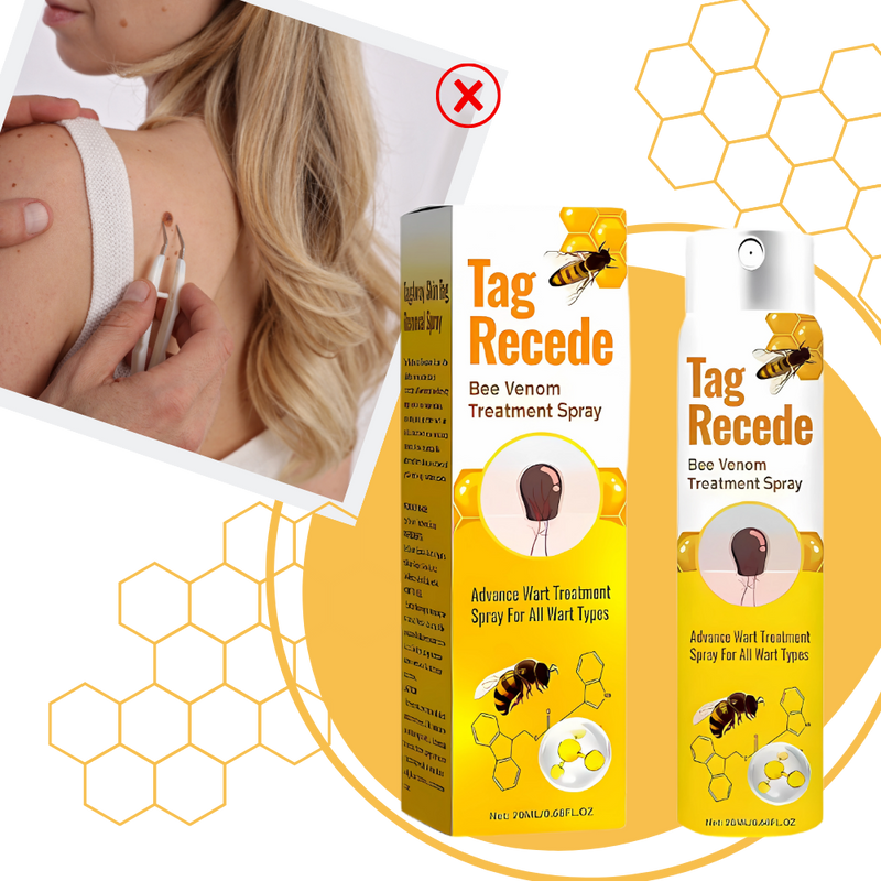 Non-Invasive Tag Recede